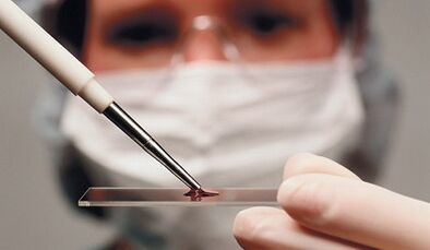 Atribūta un artrozes diferenciāldiagnoze